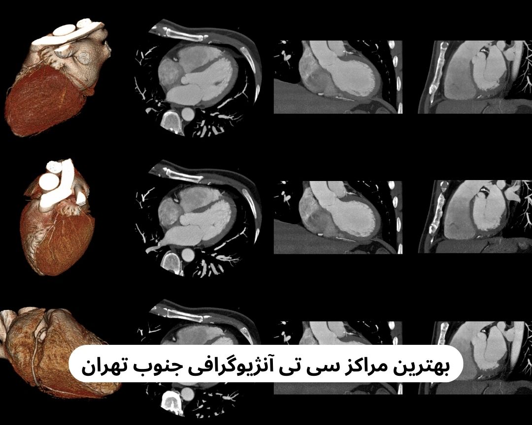 بهترین مراکز سی تی آنژیوگرافی جنوب تهران