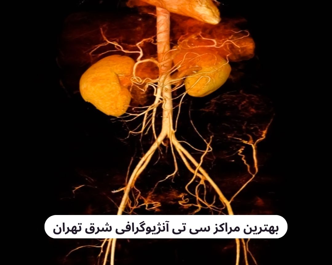 بهترین مراکز سی تی آنژیوگرافی شرق تهران