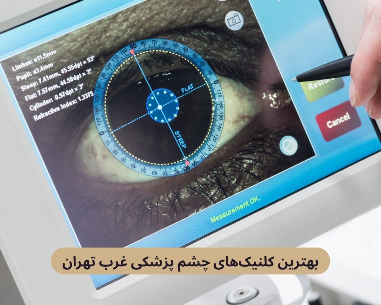 بهترین کلنیک های چشم پزشکی غرب تهران
