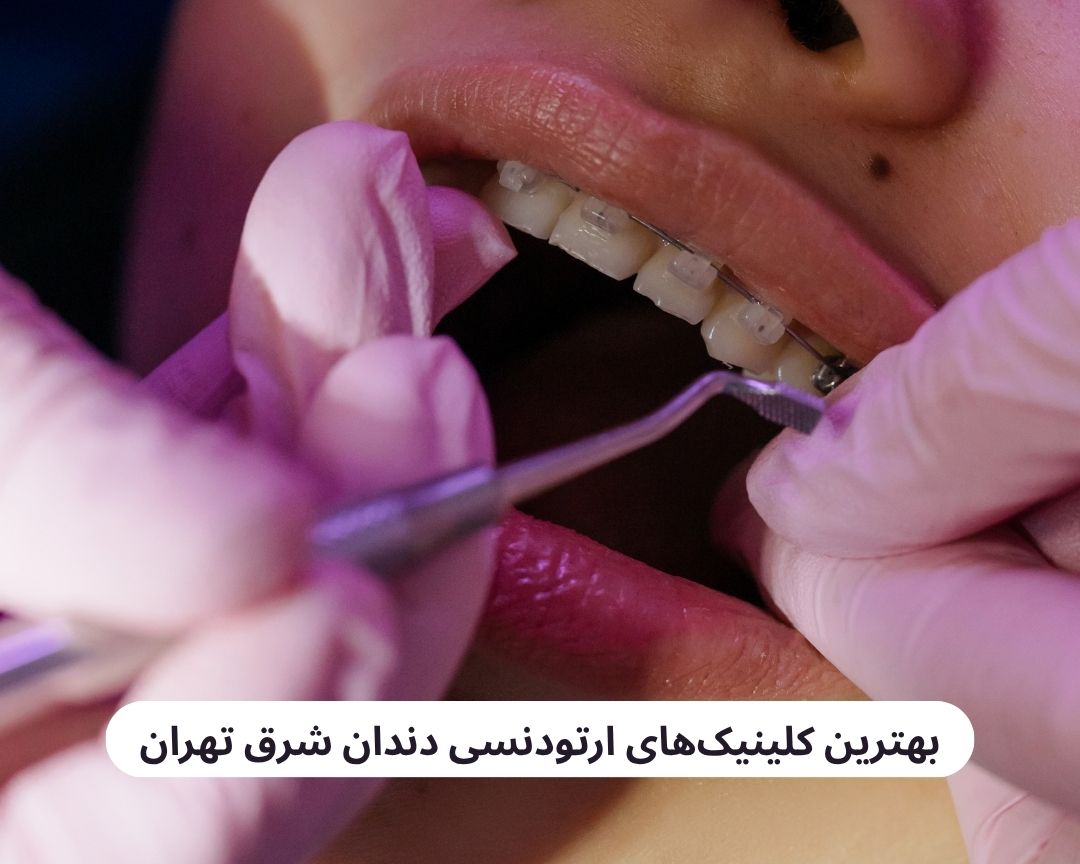 بهترین کلینیک های ارتودنسی دندان شرق تهران