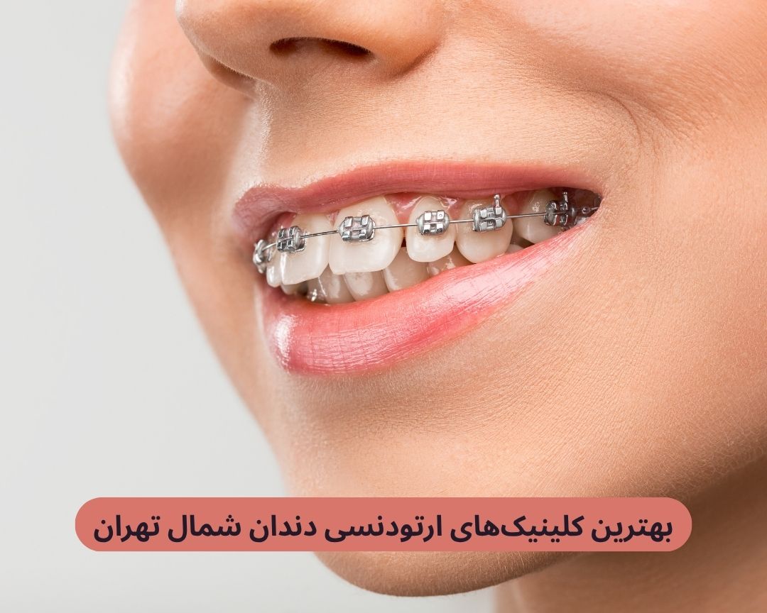 بهترین کلینیک های ارتودنسی دندان شمال تهران
