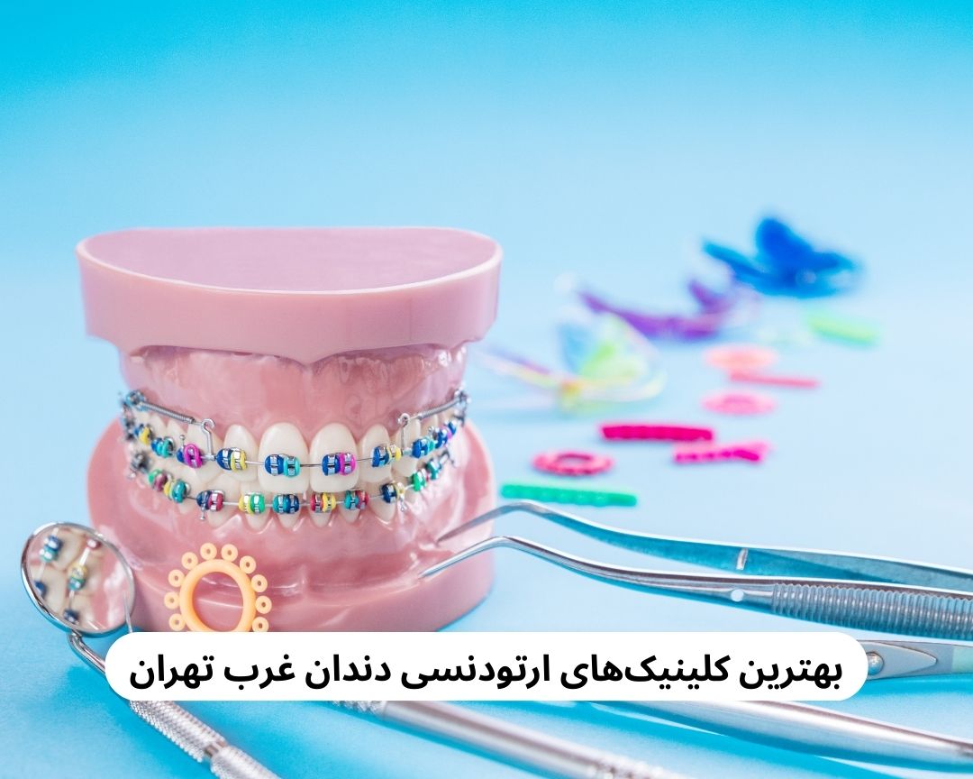 بهترین کلینیک های ارتودنسی دندان غرب تهران