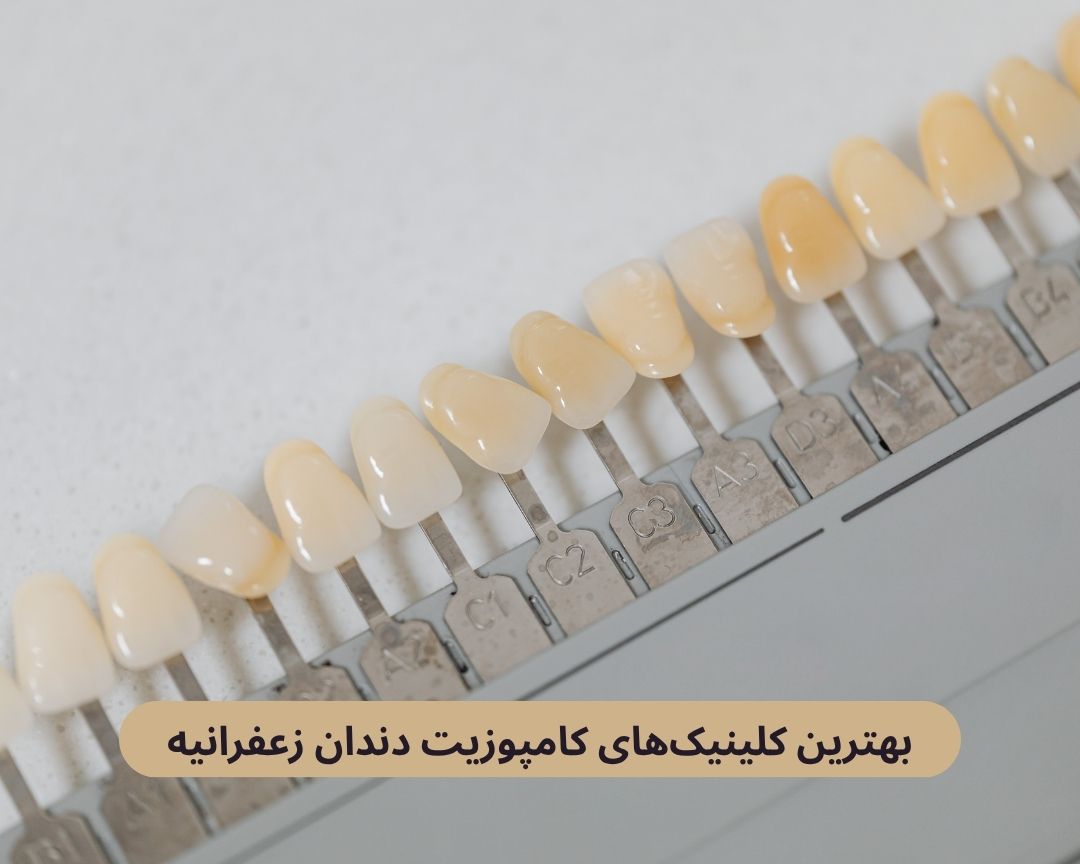 بهترین کلینیک های کامپوزیت دندان زعفرانیه