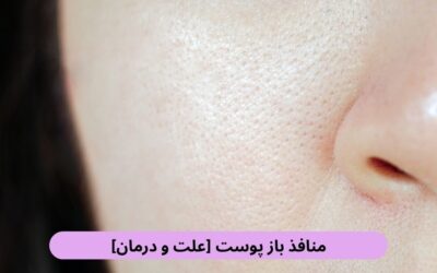 منافذ باز پوست [عوارض و درمان]