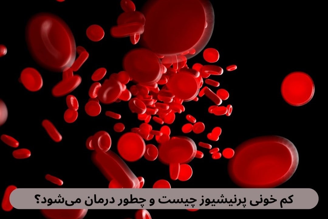 کم خونی پرنیشیوز چیست و چطور درمان می_شود؟ کم خونی پرنیشیوز نوعی کم خونی ناشی از کمبود ویتامین ۱۲B در بدن است که به کاهش تعداد گلبولهای قرمز و اختلال در انتقال اکسیژن منجر میشود.