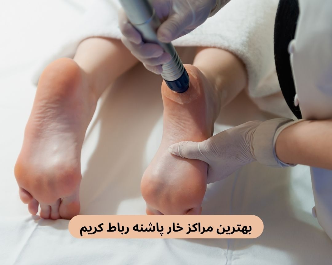 بهترین مراکز خار پاشنه رباط کریم