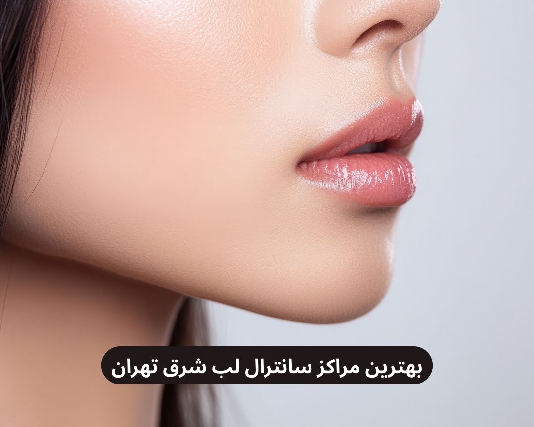 بهترین مراکز سانترال لب شرق تهران