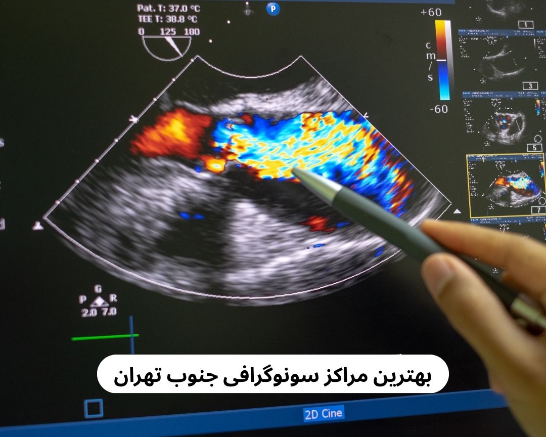 بهترین مراکز سونوگرافی جنوب تهران