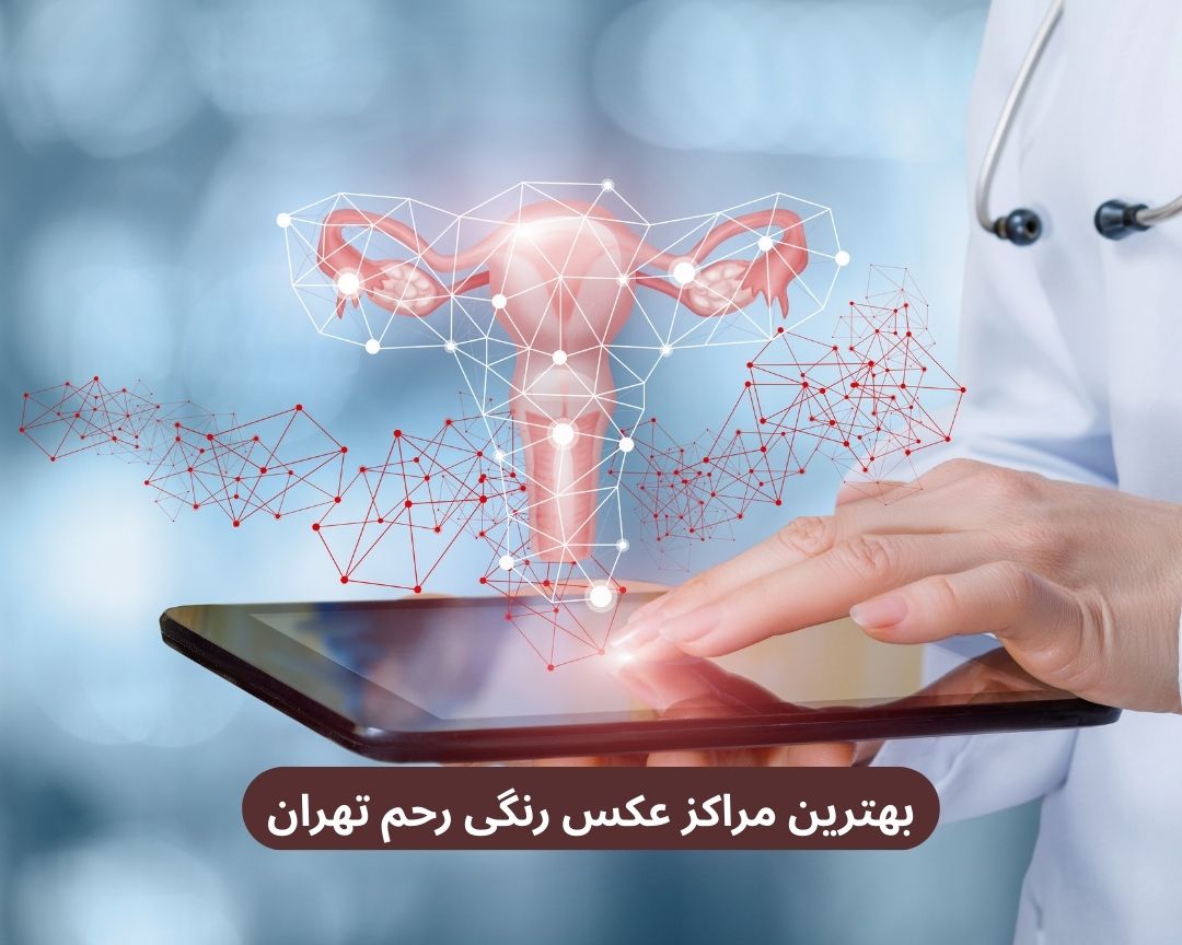 بهترین مراکز عکس رنگی رحم تهران