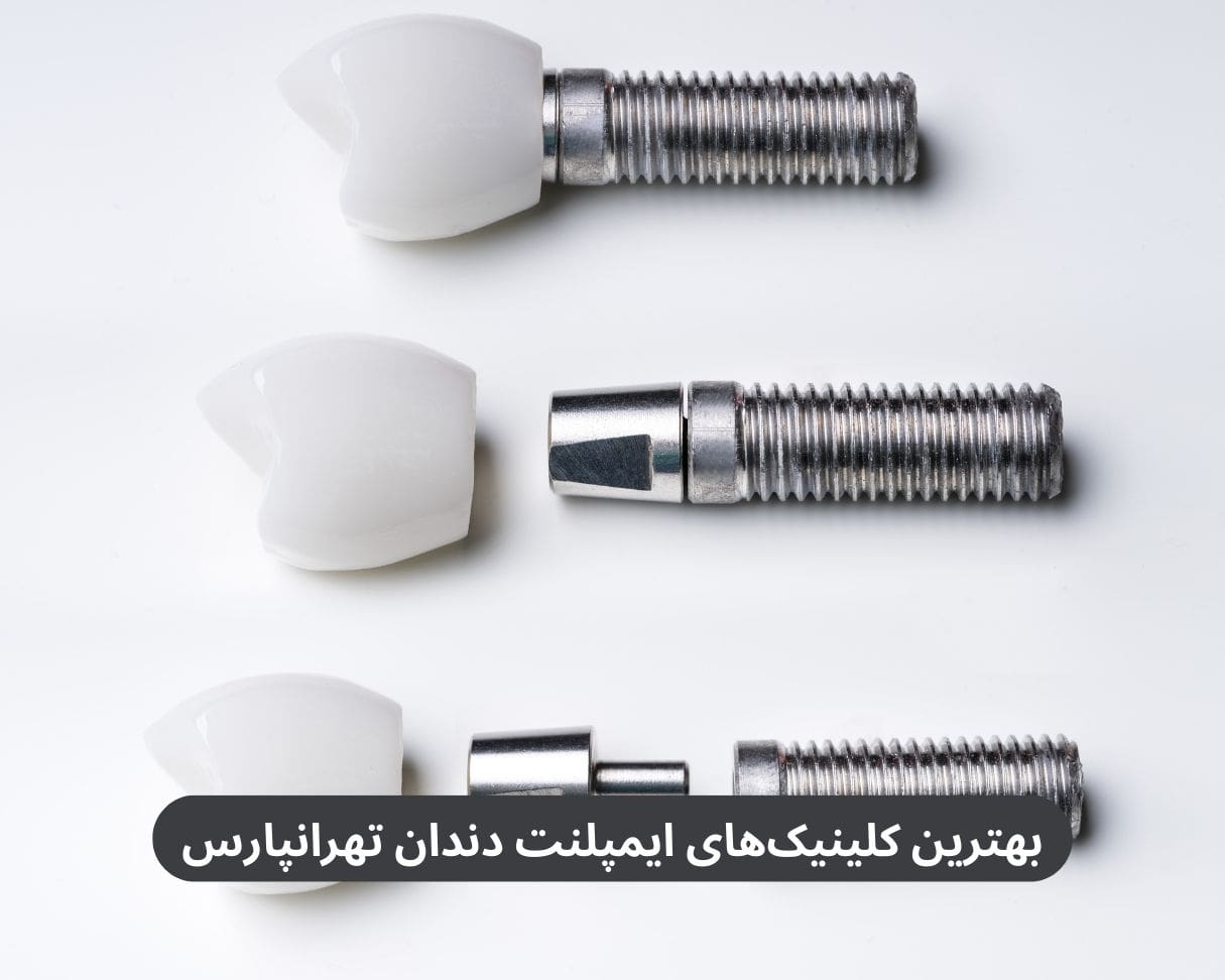 بهترین کلینیک های ایمپلنت دندان تهرانپارس