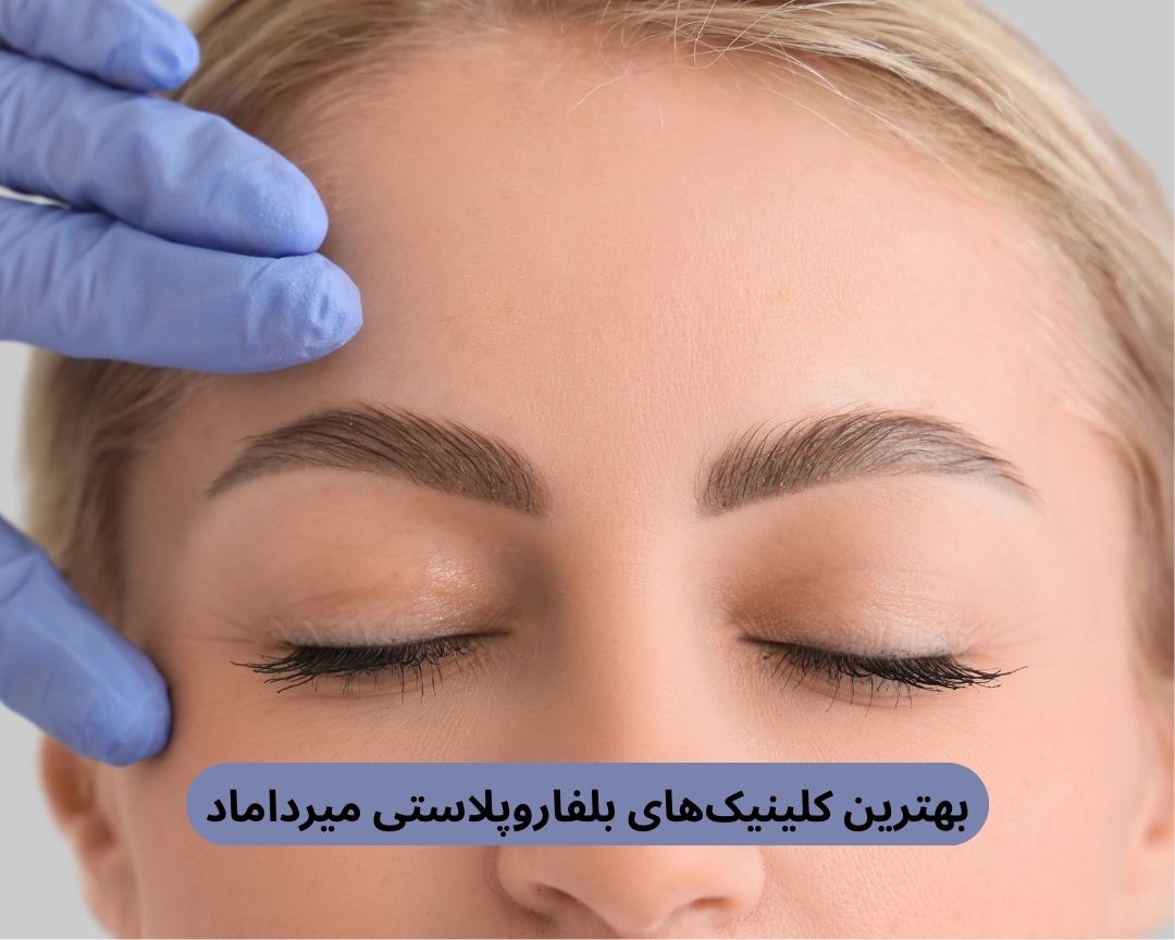 بهترین کلینیک های بلفاروپلاستی میرداماد