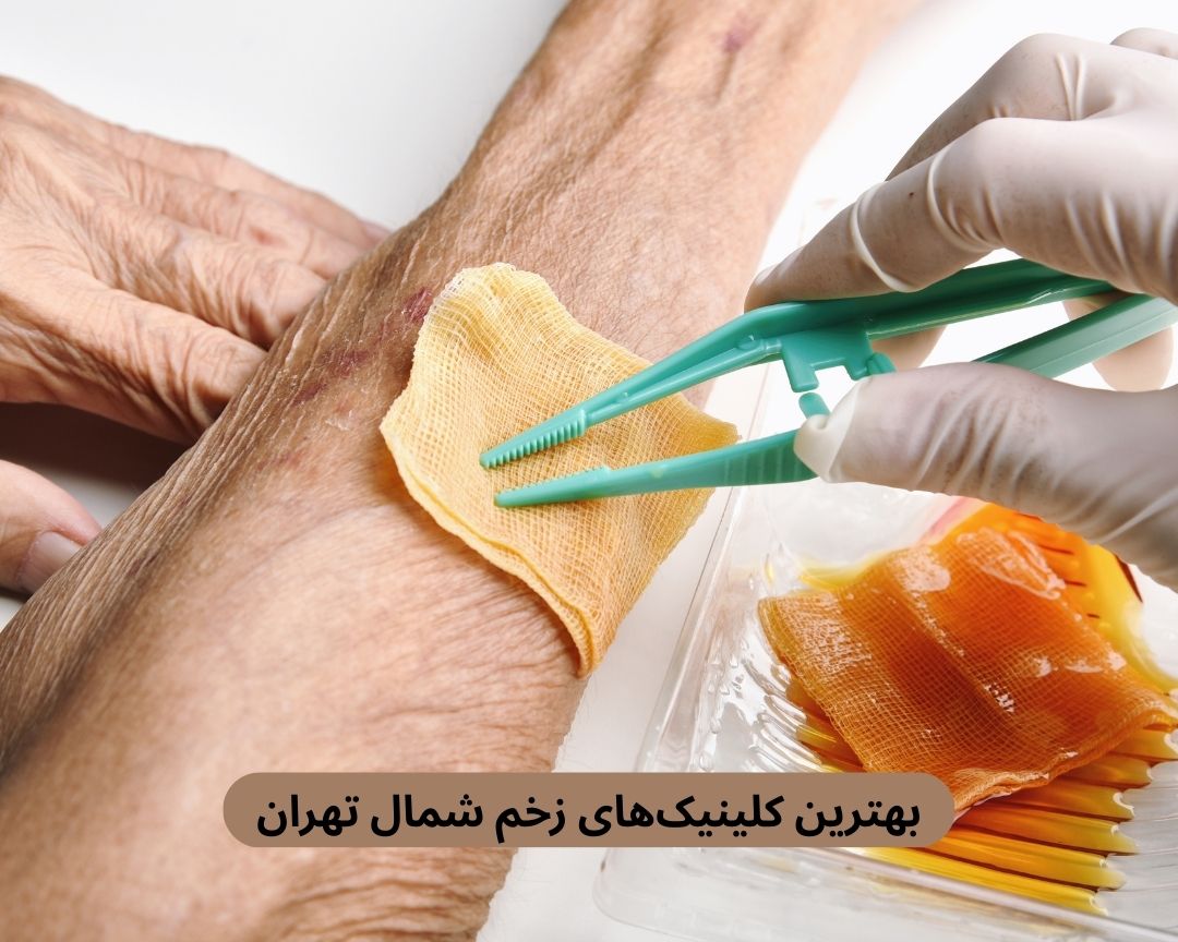 بهترین کلینیک های زخم شمال تهران