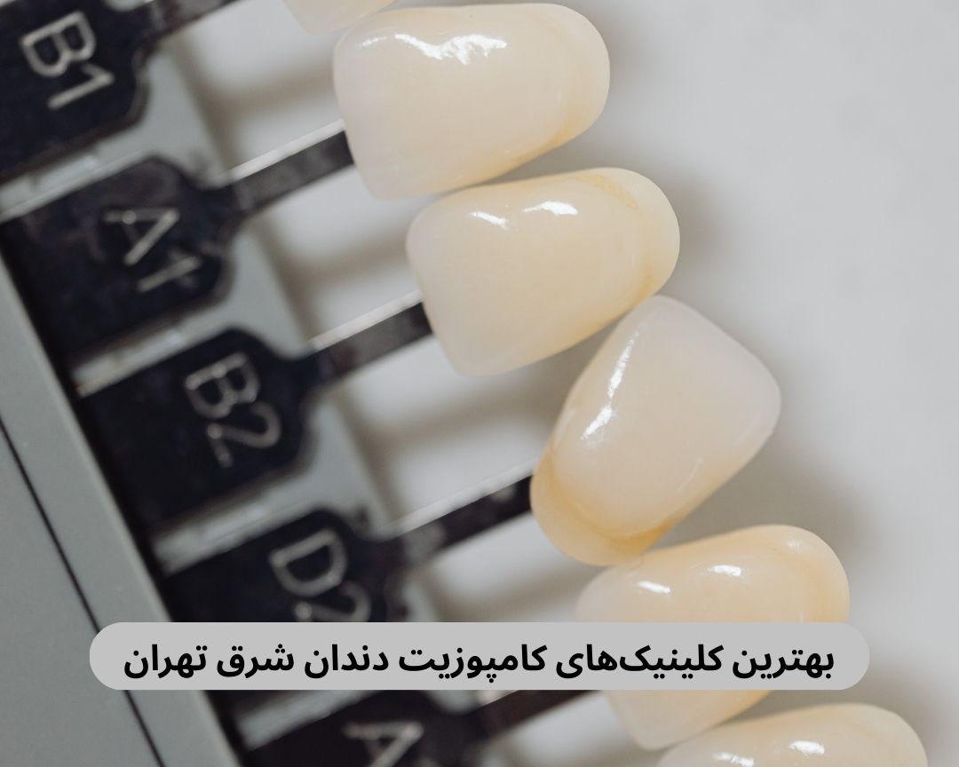بهترین کلینیک های کامپوزیت دندان شرق تهران