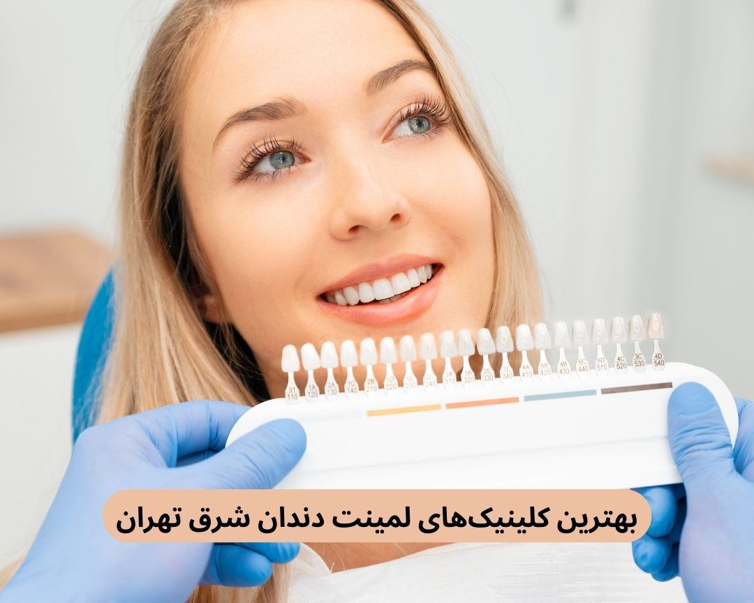 بهترین کلینیک های لمینت دندان شرق تهران