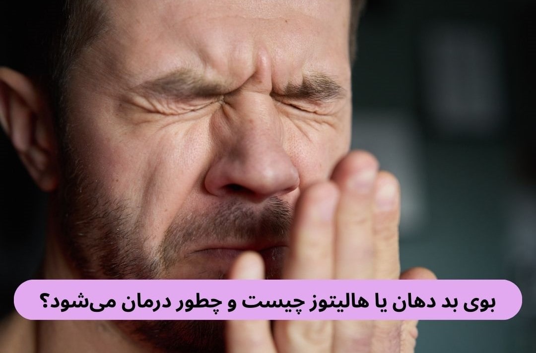 بوی بد دهان یا هالیتوز چیست و چطور درمان می_شود؟ بوی بد دهان، که به آن هالیتوز گفته میشود، مشکلی شایع است. این وضعیت باعث کاهش اعتمادبهنفس و تاثیر منفی در روابط اجتماعی میشود.