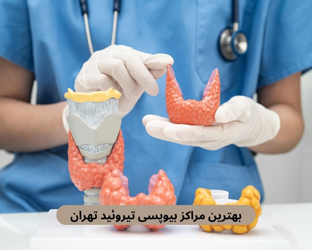 بهترین مراکز بیوپسی تیروئید تهران