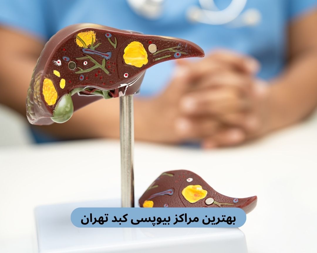 بهترین مراکز بیوپسی کبد تهران