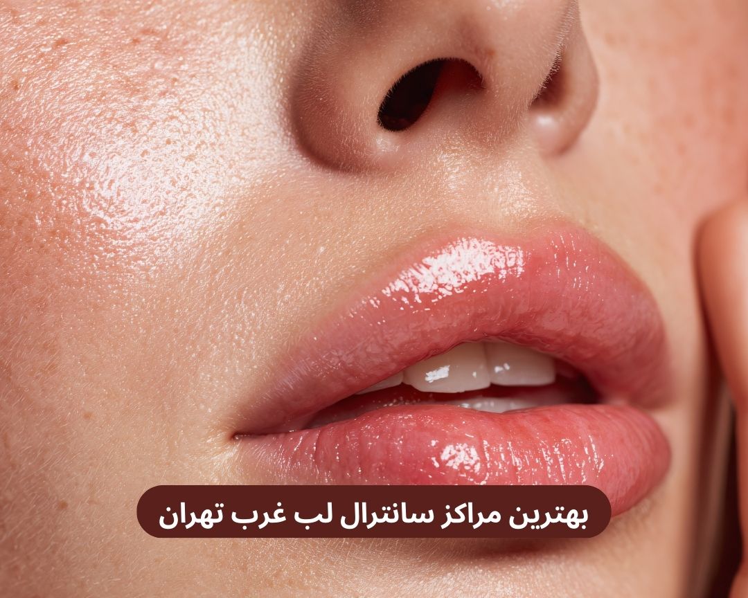 بهترین مراکز سانترال لب غرب تهران