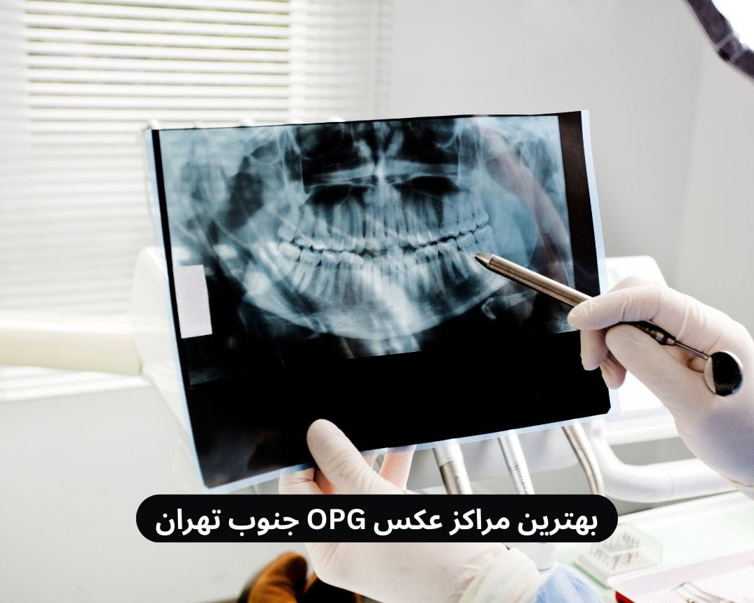بهترین مراکز عکس OPG جنوب تهران