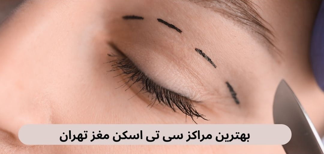 کلینیک های بلفاروپلاستی شمال تهران از جمله بهترین مراکز برای انجام این عمل سرپایی هستند. ما در اینجا این مراکز را با آدرس معرفی می‌کنیم.