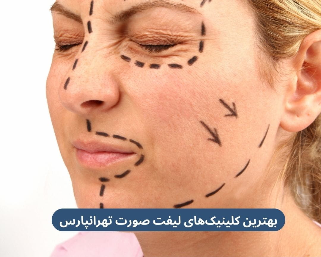 بهترین کلینیک های لیفت صورت تهرانپارس