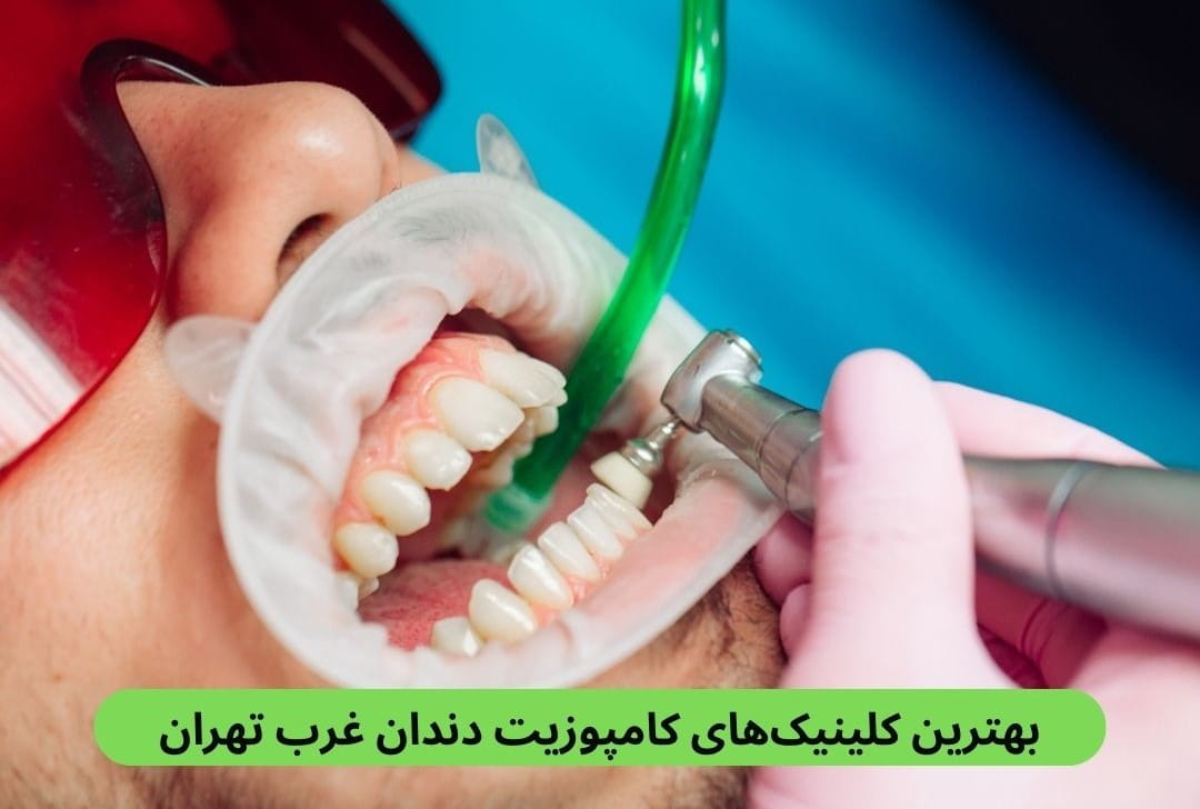 در این صفحه بهترین کلینیک های کامپوزیت دندان غرب تهران را براساس مواردی چون حضور پزشک متخصص، رضایت مردم، دسترسی و غیره معرفی می‌کنیم.