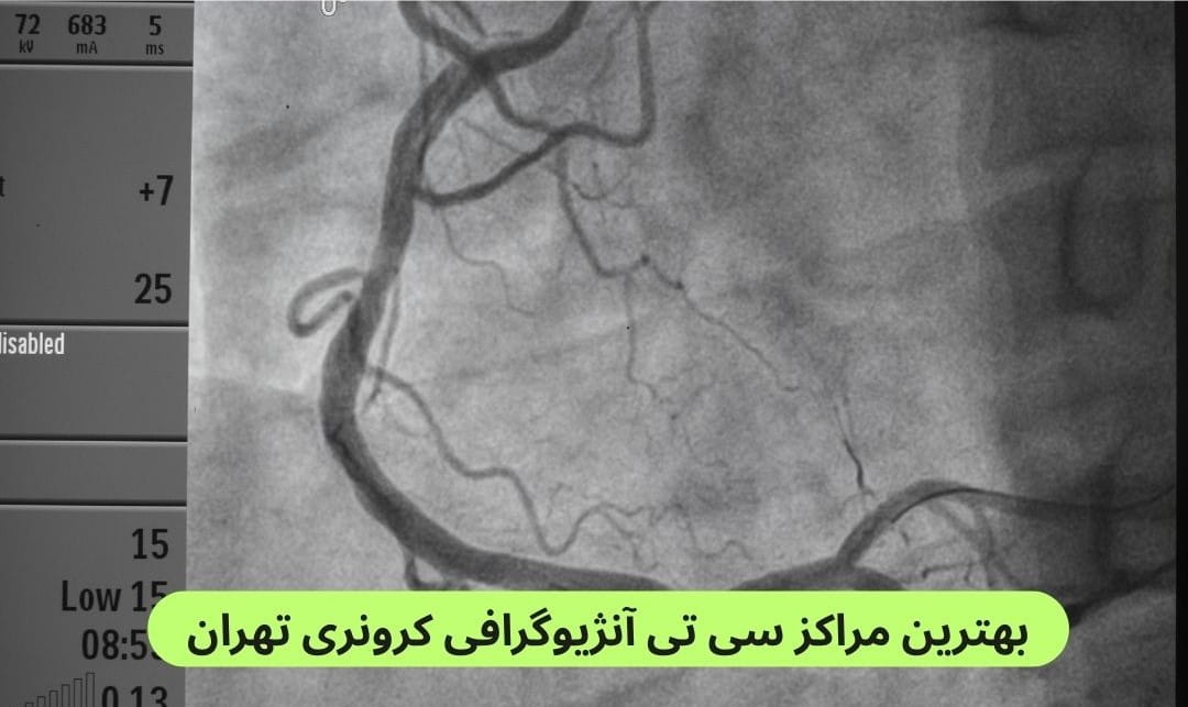 لیست بهترین مراکز سی تی آنژیوگرافی کرونری تهران براساس پارامترهایی چون کیفیت تصاویر، سرعت پاسخدهی، نظرات مردم، دسترسی و موارد دیگر.