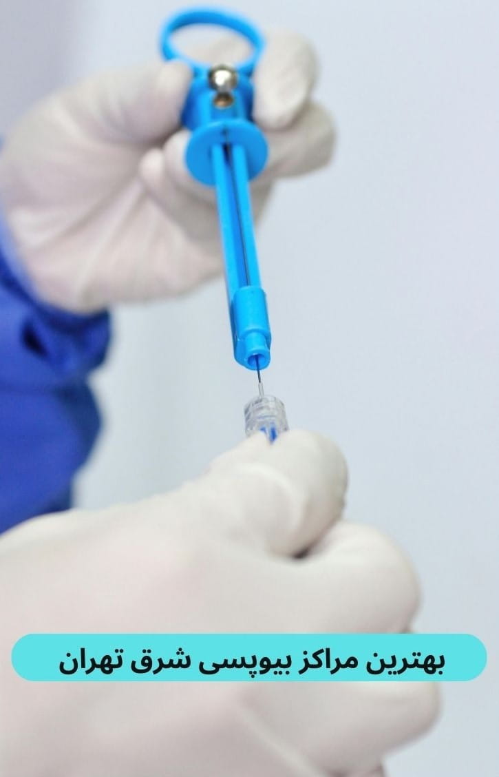 ما در ادامه به شما کمک می‌کنیم تا بهترین مرکز بیوپسی شرق تهران که هم از نظر تجهیزات و هم از نظر تخصص پزشکان در سطح بالایی باشد، بیابید.