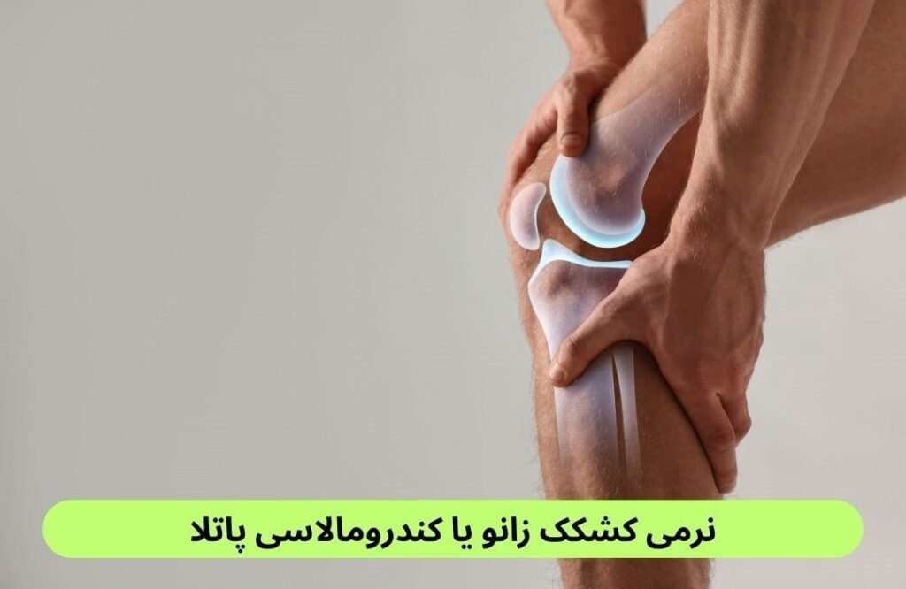 نرمی کشکک زانو یکی از شایعترین مشکلات مفصل زانو است که بیشتر در ورزشکاران و کسانی دیده میشود که زانوی خود را زیاد تحت فشار قرار میدهند.