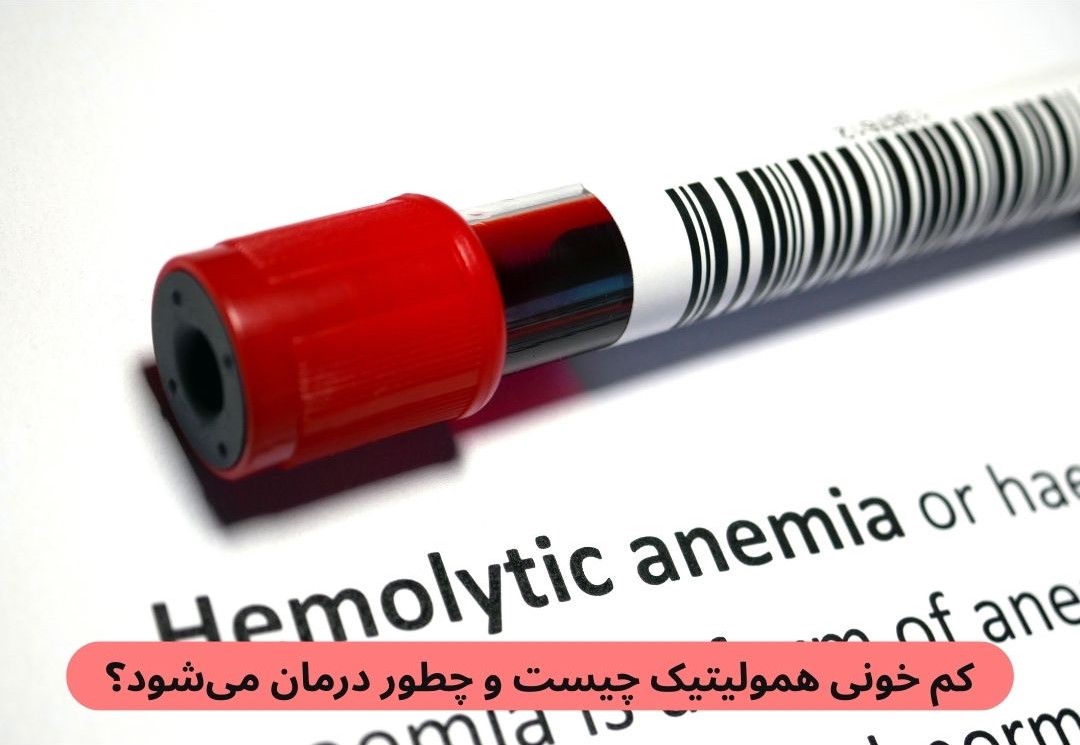 کم‌ خونی همولیتیک نوعی اختلال خونی است که در آن گلبول‌های قرمز خون سریع‌تر از آنکه مغز استخوان بتواند آن‌ها را جایگزین کند از بین می‌روند.