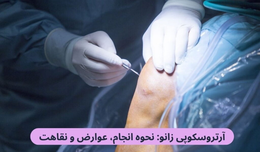 آرتروسکوپی زانو به جراحان اجازه میدهد تا بدون نیاز به ایجاد برشهای بزرگ و سنتی، فضای داخلی مفصل زانو را بهطور مستقیم مشاهده و درمان کنند