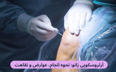 آرتروسکوپی زانو: نحوه انجام، عوارض و نقاهت
