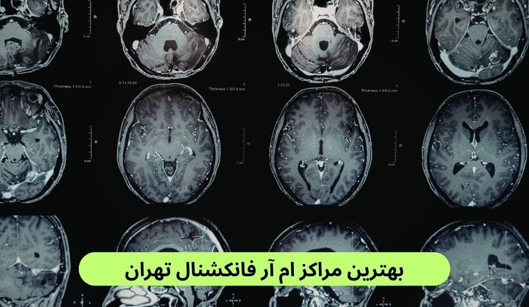 لیست بهترین مراکز ام آر آی فانکشنال تهران براساس پارامترهایی چون کیفیت خدمات، رضایت مردم، دسترسی، سرعت پاسخ‌دهی و موارد دیگر.