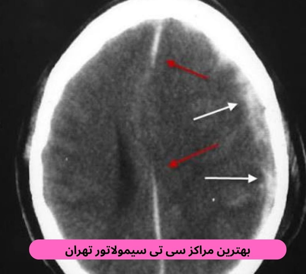 در این صفحه بهترین مراکز سی تی سیمولاتور تهران را براساس رضایت مردم معرفی کرده و توضیحاتی درباره این روش ارائه می‌دهیم.