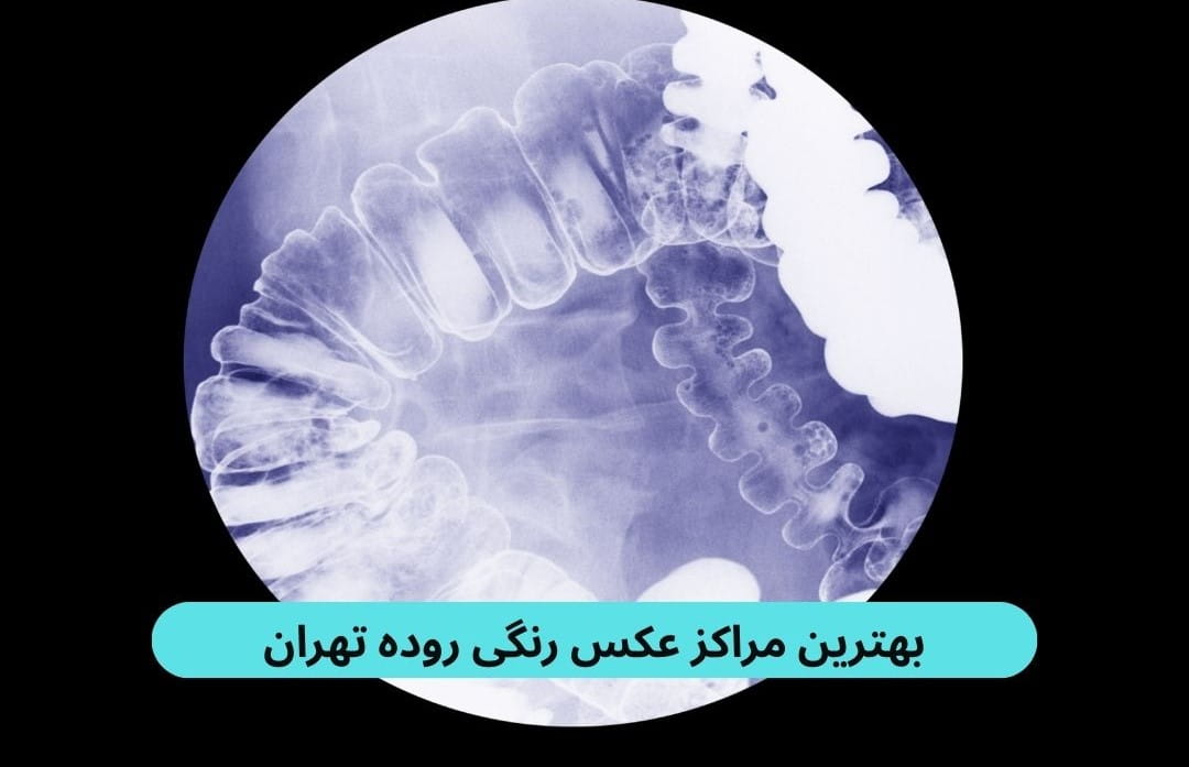 لیست بهترین مراکز عکس رنگی روده تهران براساس پارامترهایی چون به روز بودن دستگاه‌ها، کیفیت خدمات، رضایت مردم و موارد دیگر.