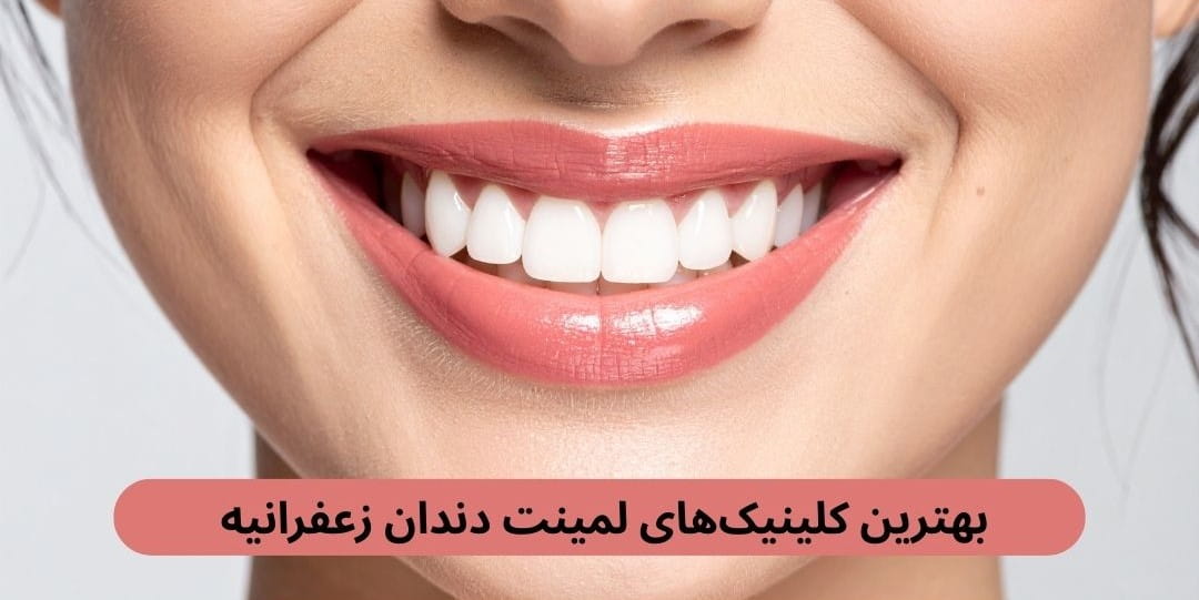 لیست بهترین کلینیک های لمینت دندان زعفرانیه براساس پارامترهایی چون حضور پزشکان متخصص، رضایت مراجعین، دسترسی و موارد دیگر.