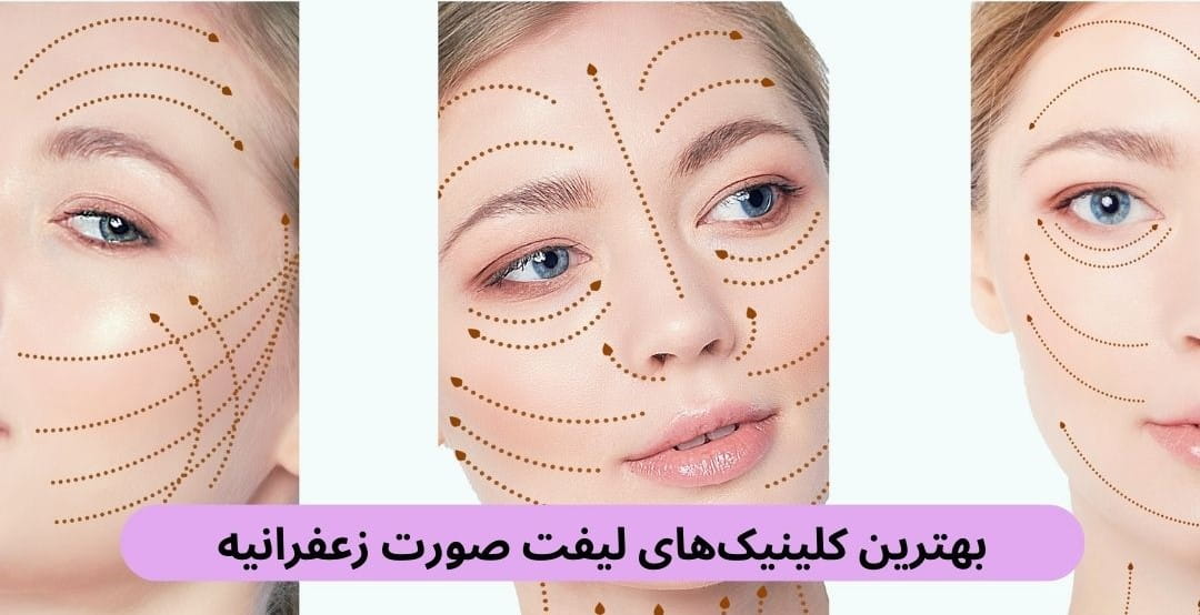 برای انتخاب بهترین کلینیک های لیفت صورت زعفرانیه باید به پارامترهایی از قبیل تصاویر قبل و بعد، حضور پزشکان متخصص، رضایت مردم و.. توجه کنید.