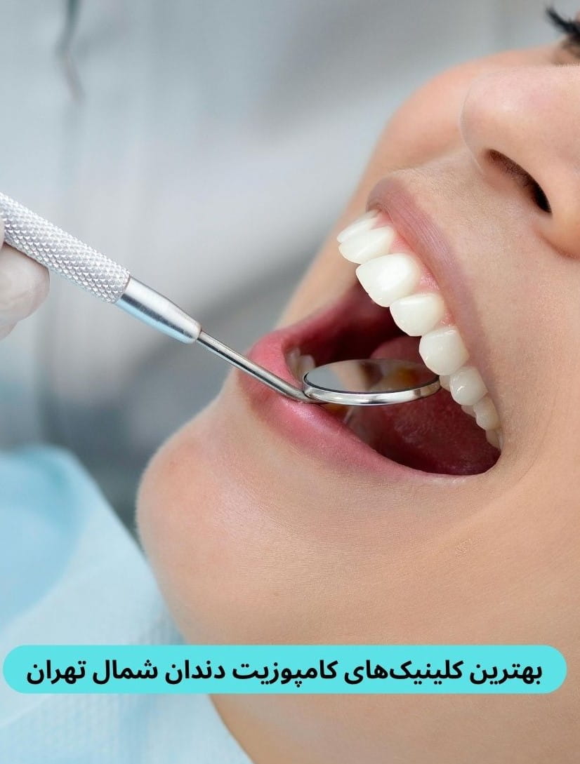 ما در این مقاله به شما کمک می‌کنیم بهترین کلینیک های کامپوزیت دندان شمال تهران را یافته و از بین آنها مناسب‌ترین را انتخاب کنید.