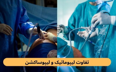 تفاوت لیپوماتیک و لیپوساکشن