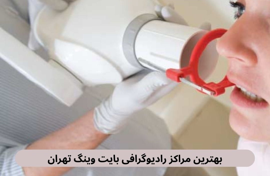 ما در این صفحعه، برخی از بهترین مراکز رادیوگرافی بایت وینگ را براساس نظرات مردم، کیفیت تصاویر، دسترسی و مواردی از این قبیل معرفی می‌کنیم.