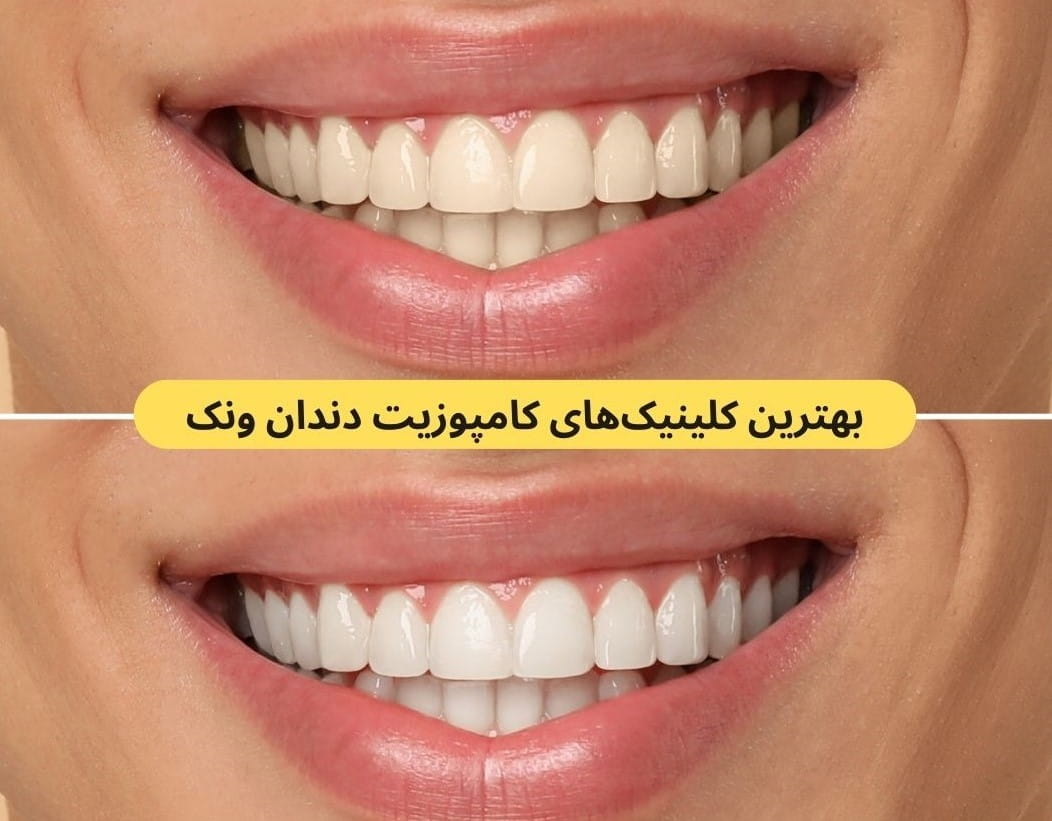 ما در این صفحه به شما در پیدا کردن بهترین کلینیک های کامپوزیت دندان براساس رضایت مراجعین، دسترسی، کیفیت خدمات و غیره کمک می‌کنیم.