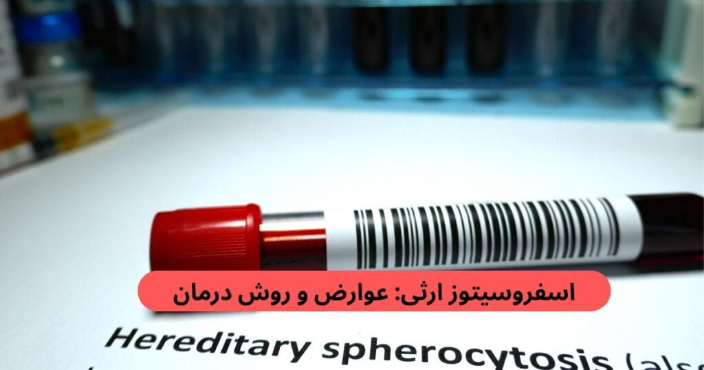 بیماری اسفروسیتوز ارثی نوعی بیماری خونی ژنتیکی است که در آن شکل و ساختمان گلبولهای قرمز خون غیرطبیعی میشود.