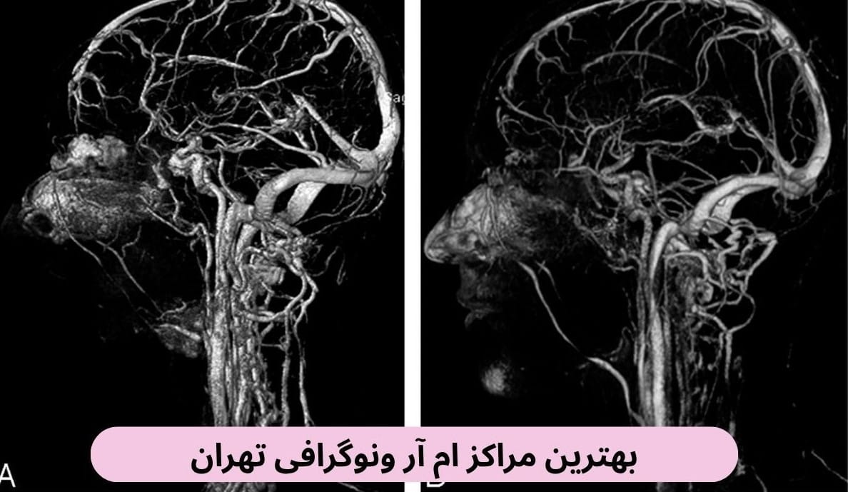 ما در این صفحه لیست بهترین مراکز ام آر ونوگرافی تهران را به همراه آدرس و براساس نظرات مردم برای شما دسته بندی کرده‌ایم.