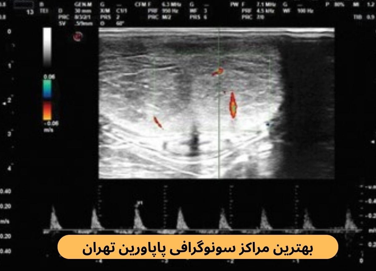 لیست بهترین مراکز سونوگرافی پاپاورین تهران براساس مواردی چون کیفیت خدمات، نوبت‌دهی آنلاین، رضایت مراجعین، داشتن بیمه و موارد دیگر.