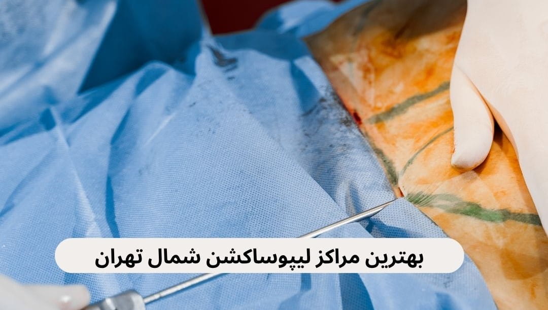 لیست بهترین مراکز لیپوساکشن شمال تهران براساس مواردی چون لیست قیمت‌ها، رضایت مراجعین، داشتن مجوز، دسترسی و موارد دیگر.