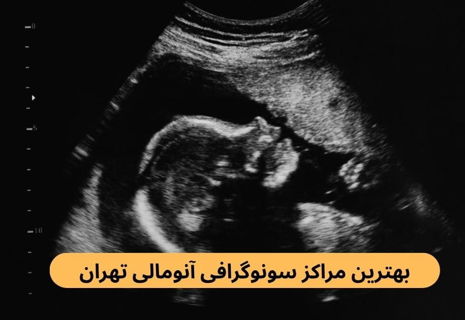 برای یافتن بهترین مرکز سونوگرافی آنومالی تهران باید پارامترهایی چون به روز بودن دستگاه‌ها، کیفیت خدمات، رضایت مراجعین و غیره را بررسی کنید.