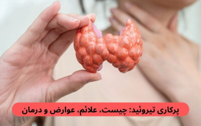 پرکاری تیروئید: چیست، علائم، عوارض و درمان