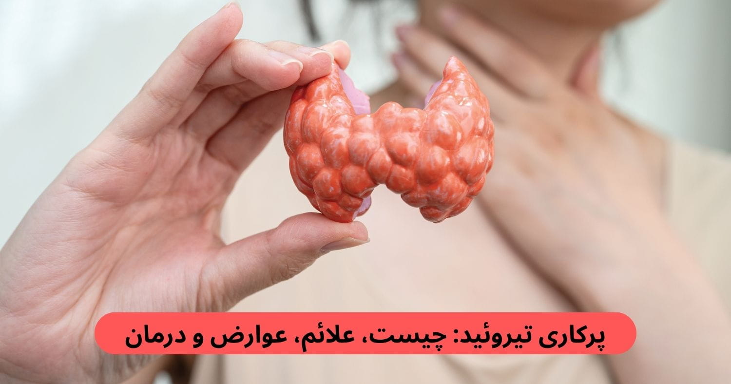پرکاری تیروئید زمانی رخ می‌دهد که غده تیروئید بیش از نیاز بدن هورمون تولید کند. این اتفاق می‌تواند سرعت فعالیت‌های بدن را بالا ببرد.