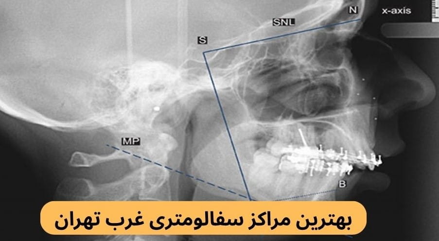 لیست بهترین مراکز سفالومتری غرب تهران به همراه آدرس براساس نظرات مردم، به روز بودن دستگاه‌ها، کیفیت خدمات، داشتن مجوز و موارد دیگر.