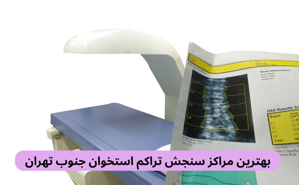 بهترین مراکز سنجش تراکم استخوان جنوب تهران لیست بهترین مراکز سنجش تراکم استخوان جنوب تهران براساس پارامترهایی چون دسترسی، کیفیت خدمات، رضایت مردم، نوبتدهی آنلاین و موارد دیگر.